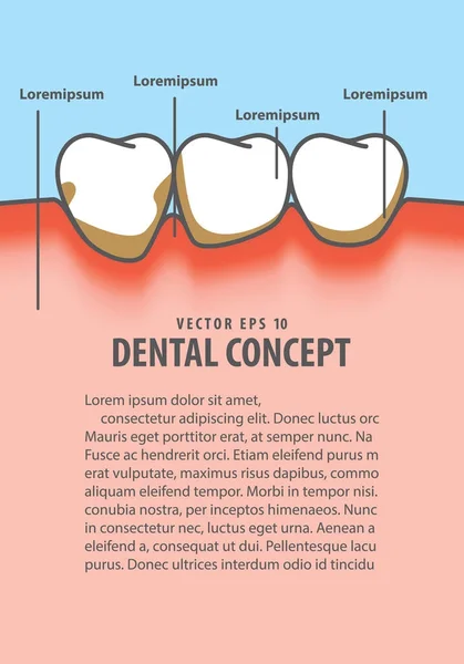 Layout menschlichen Zahnfleischentzündung Frame Cartoon-Stil für Informationen oder bo — Stockvektor