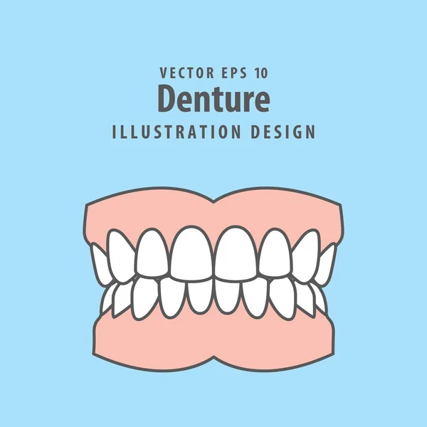 Vector de ilustración de prótesis dentales sobre fondo azul. Concepto dental . — Archivo Imágenes Vectoriales