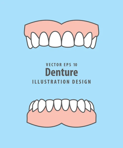 Vector de ilustración de prótesis dentales sobre fondo azul. Concepto dental . — Archivo Imágenes Vectoriales