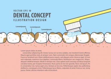 Bilgi ya da kitap için stil düzen Brushing çok kirli diş çizgi film 