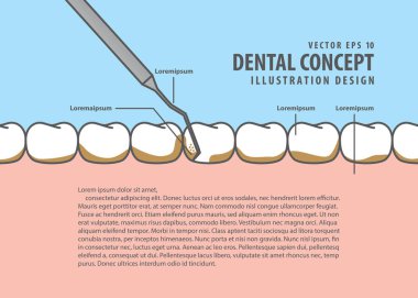 Düzen ölçekleme diş illüstrasyon vektör mavi zemin üzerine. Den