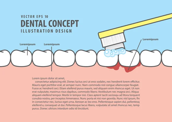 Amikor fogmosás illusztráció vektor kék háttérben elrendezés vérzés — Stock Vector