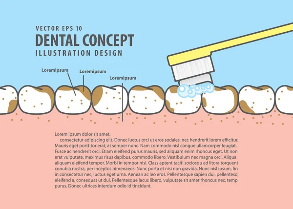 Diseño Cepillado dientes muy sucios estilo de dibujos animados para información o libro — Archivo Imágenes Vectoriales