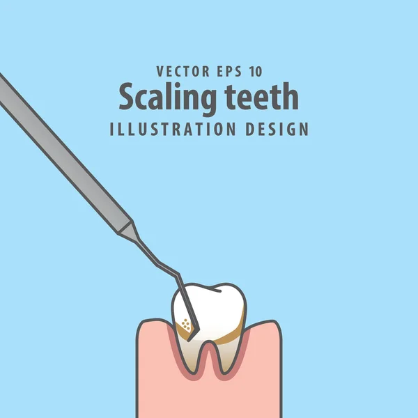 Scala vettore illustrazione denti su sfondo blu. Condizione dentale — Vettoriale Stock
