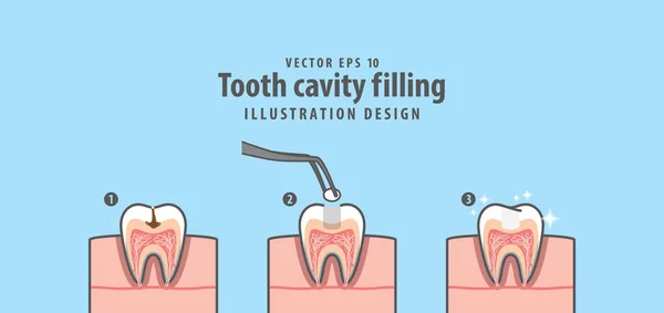 Toot kesit yapısı doldurma diş boşluğu adım — Stok Vektör