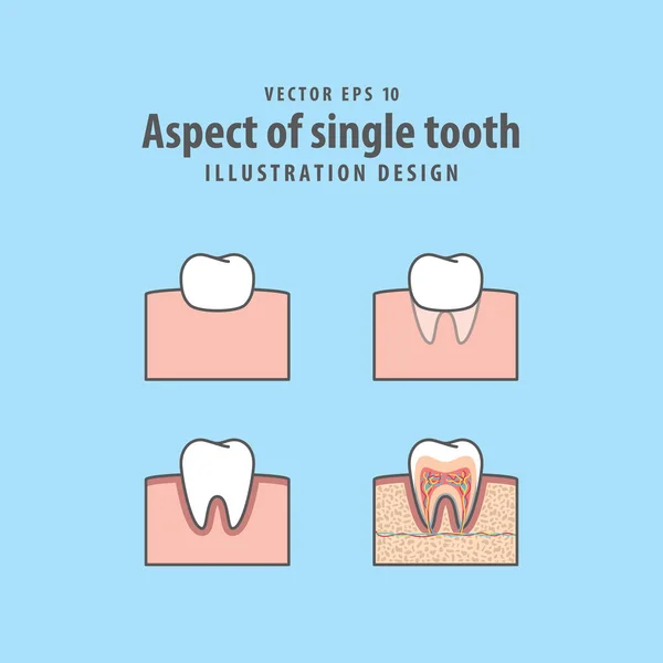 Aspect of single tooth illustration vector on blue background. D — Stock Vector