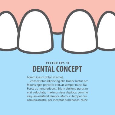 Düzen closeup diastema dişleri illüstrasyon vektör mavi 