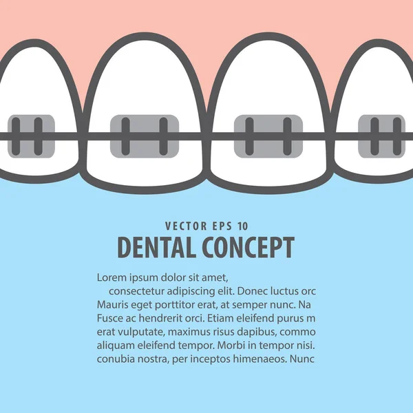 Diseño primer plano frenos dientes superiores ilustración vector en ba azul — Archivo Imágenes Vectoriales