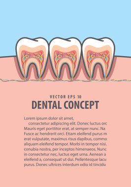 Düzen kesit yapısı içinde diş illüstrasyon vektör 