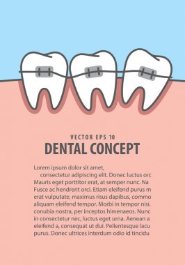  Düzen diş illüstrasyon vektör mavi zemin üzerine diş teli. De