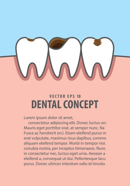 Layout Cáries e dentes cavidade ilustração vetor em azul backg —  Vetores de Stock