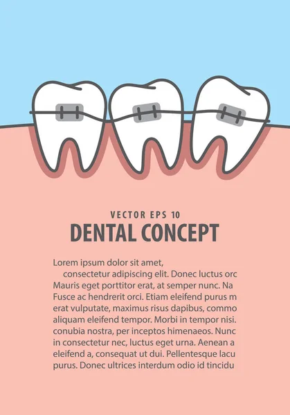 Layout braces teeth  illustration vector on blue background. De — Stock Vector