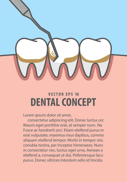 Mise en page Mise à l'échelle des dents vecteur d'illustration sur fond bleu. Den — Image vectorielle