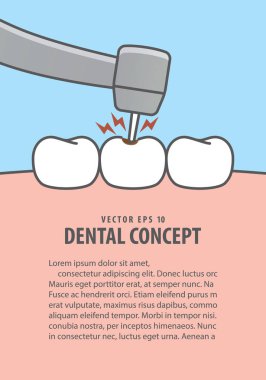 Düzen çürük diş tedavisi (çürük) illüstrasyon vektör blu üzerinde
