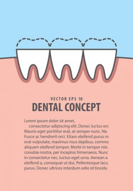 Düzen yıpratma (bruksizm) diş illüstrasyon vektör mavi bac üzerinde