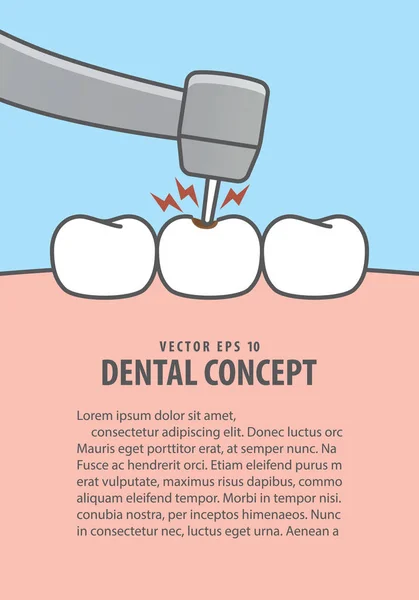 Layout decadência tratamento dentário (Caries) vetor de ilustração em blu — Vetor de Stock