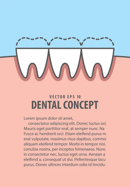 Layout attrition (Bruxism) teeth illustration vector on blue bac — Stock Vector