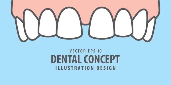 Bannière supérieure Diastema dents illustration vecteur sur fond bleu — Image vectorielle