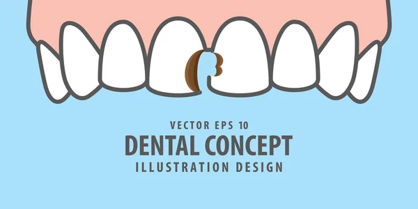 Bannière Dents des cavités supérieures vecteur d'illustration sur fond bleu — Image vectorielle