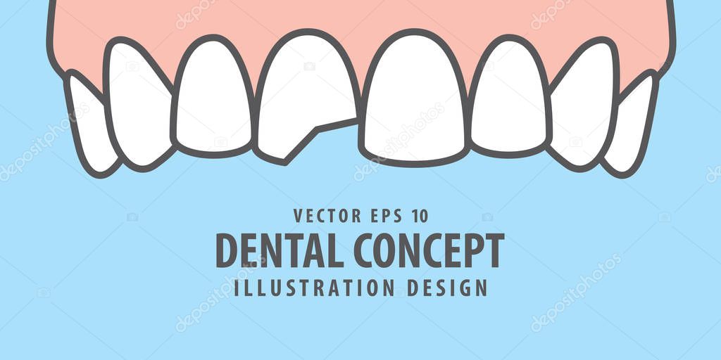 Banner Upper Chipped tooth illustration vector on blue backgroun