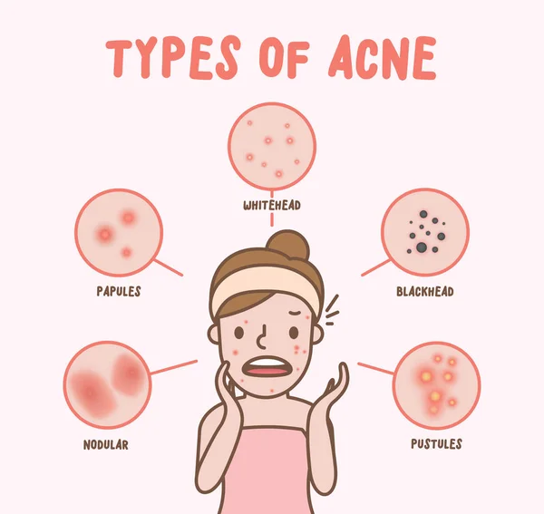 Tipi di acne con donna fumetto illustrazione vettore su bac rosa — Vettoriale Stock