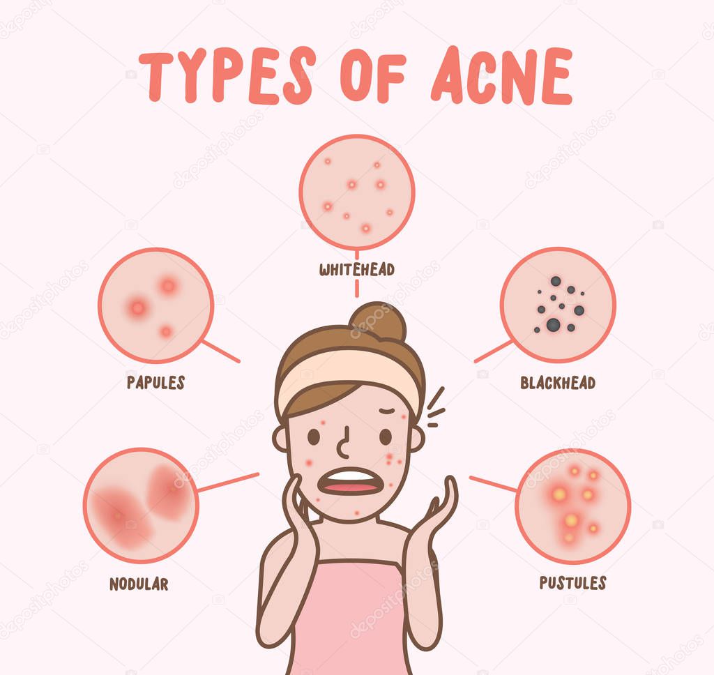 Types of acne with woman cartoon illustration vector on pink bac