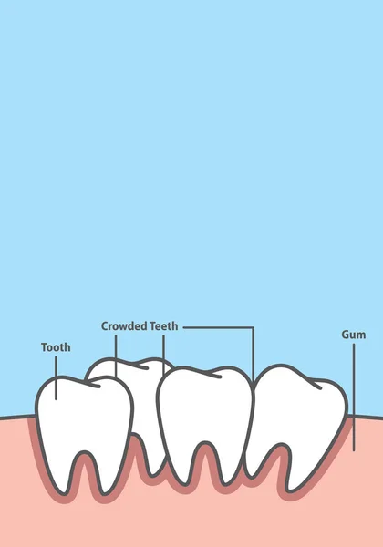 Banner em branco Crowding estilo desenho animado quadro dente para informações ou livro —  Vetores de Stock