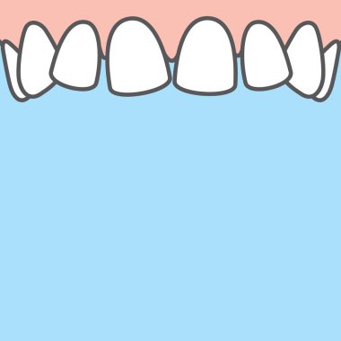 Boş pankart Mavi sırt üzerinde çarpık diş illüstrasyon vektörü