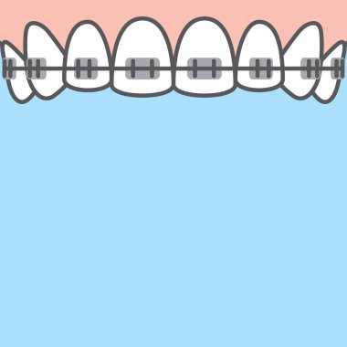 Mavi sırtlı boş pankart diş teli illüstrasyon vektörü