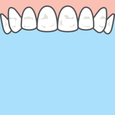 B 'deki diş illüstrasyon vektöründe boş Yukarı Beyaz noktalar