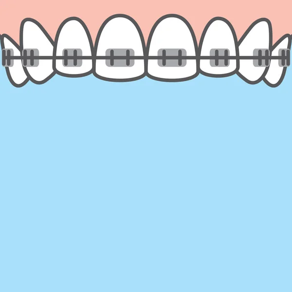 Üres banner Felső fogszabályzó fogak illusztráció vektor kék hát — Stock Vector