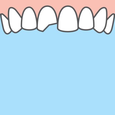 Mavi torba üzerinde boş sancak Üst Kırık diş illüstrasyon vektörü