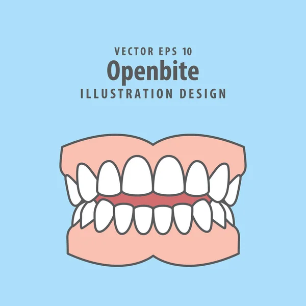 Dientes Mordida Abierta Dental Ilustración Diseño Vectorial Sobre Fondo Azul — Vector de stock