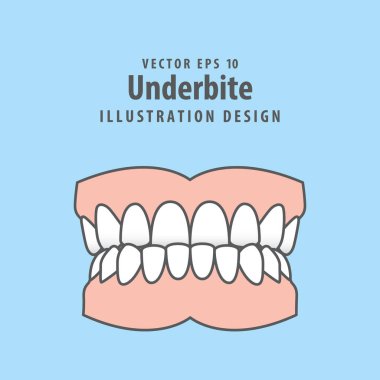 Dental underbite teeth illustration vector design on blue background. Dental care concept. clipart