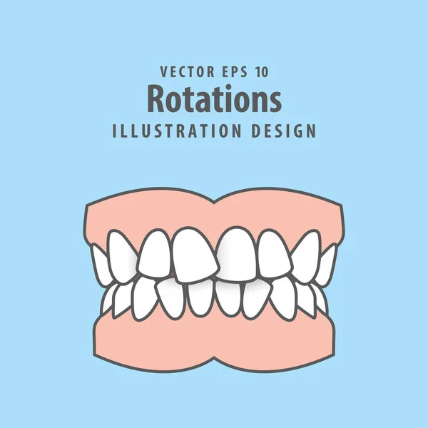 Rotazioni Dentali Disegno Dei Denti Illustrazione Vettoriale Sfondo Blu Concetto — Vettoriale Stock