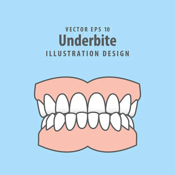 Dentes Dentários Underbite Ilustração Desenho Vetorial Fundo Azul Conceito Assistência —  Vetores de Stock