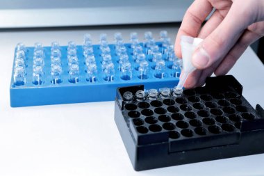 Özerk çözünürlük tester. İnsan mide tablet imitasyon dağılması. Bilimsel araştırma, eczacılık labaratuarı için. Adam tesisinde bilimsel çalışmaları yürütmektedir. Laboratuar araştırmaları eczane. Erveka iş. Otomatik dissol