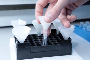 Özerk çözünürlük tester. İnsan mide tablet imitasyon dağılması. Bilimsel araştırma, eczacılık labaratuarı için. Adam tesisinde bilimsel çalışmaları yürütmektedir. Laboratuar araştırmaları eczane. Erveka iş. Otomatik dissol