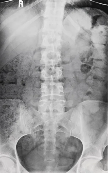 Radiographie de la colonne vertébrale et du bassin — Photo