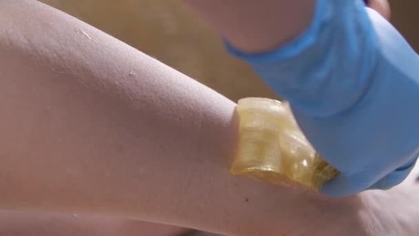 Szépség és testápolás. Sugárzó epiláció bőrápolás folyékony cukorral a lábaknál — Stock videók