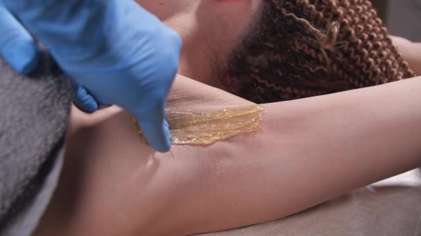 Beauty and body care concept. Sugaring: epilation with liquate sugar at armpit — Stock Video
