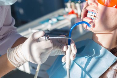 Yordam close-up diş beyazlatma