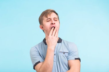 Yorgun ya da bıkkın Kafkas hipster genç kapsayan ağız esneme sırasında bir adam iş zor bir gün sonra yorgun hissediyorum. Uykulu sıkıcı sahip yakışıklı erkek öğrenci