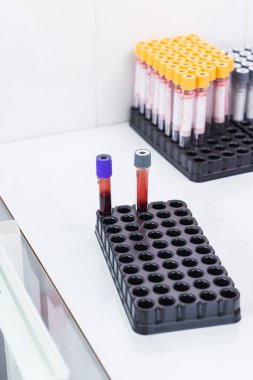 Covid-19, pandemik ve koronavirüs konsepti - laboratuvarda test tüplerinde kan.