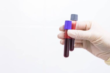 Covid-19, pandemik ve koronavirüs konsepti - test tüplerinde kan tutma tüpleri kapalı, kopyalama alanı olan beyaz arkaplan.