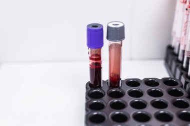 Covid-19, pandemik ve koronavirüs konsepti - laboratuvarda test tüplerinde kan.