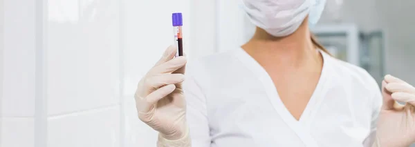 Covid-19, Coronavirus, Pandemie und Viruskonzept - Frau hält Blut in Reagenzgläsern in Großaufnahme, Hintergrund mit Kopierraum. — Stockfoto