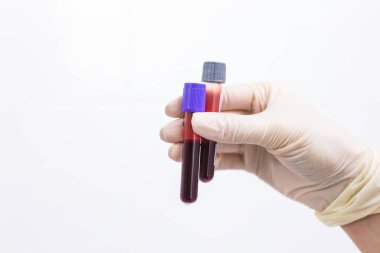 Covid-19, pandemik ve koronavirüs konsepti - test tüplerinde kan tutma tüpleri kapalı, kopyalama alanı olan beyaz arkaplan.