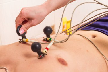 Tıp, sağlık ve kalp kontrolü konsepti - Hastanede ECG elektrokardiyogramı olan erkek hasta
