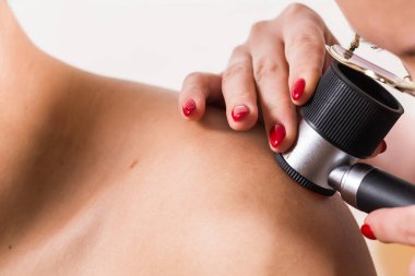 Deri lezyonları ve benlerin dermoskopi yöntemi. Melanoma ve Cilt Kanseri Önleniyor